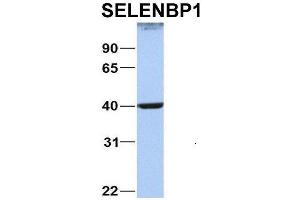 Host:  Rabbit  Target Name:  NOP56  Sample Type:  MCF7  Antibody Dilution:  1. (SELENBP1 antibody  (C-Term))
