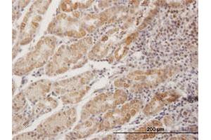 Immunoperoxidase of purified MaxPab antibody to MPPED1 on formalin-fixed paraffin-embedded human stomach. (MPPED1 antibody  (AA 1-326))