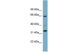 WB Suggested Anti-ZNF791 Antibody Titration:  0. (ZNF791 antibody  (N-Term))
