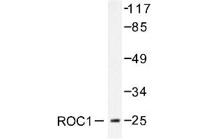 Image no. 1 for anti-Ras-Like Without CAAX 1 (RIT1) antibody (ABIN271808) (RIT1 antibody)