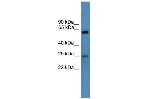 WB Suggested Anti-TP53RK Antibody Titration: 0. (TP53RK antibody  (N-Term))