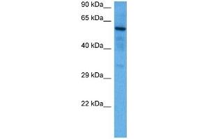 Host:  Rabbit  Target Name:  SOX9  Sample Tissue:  Mouse Brain  Antibody Dilution:  1ug/ml (SOX9 antibody  (N-Term))