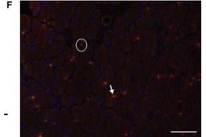 (A) T cells (CD3+ cells) were increased at 2 and 7 days postinjury (DPI) compared to 14 DPI (*, P < 0. (CXCR3 antibody  (AA 301-367))