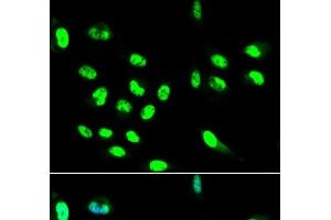 Immunofluorescence analysis of HepG2 cells using FCGR2A Polyclonal Antibody (FCGR2A antibody)