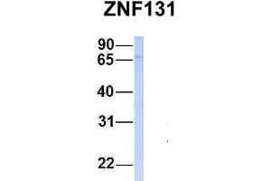 Host:  Rabbit  Target Name:  ZNF131  Sample Type:  Jurkat  Antibody Dilution:  1. (ZNF131 antibody  (N-Term))