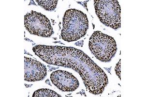 IHC analysis of SAE1 using anti-SAE1 antibody (ABIN7601346). (SAE1 antibody  (AA 33-299))
