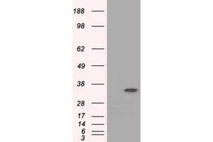 HEK293T cells were transfected with the pCMV6-ENTRY control (Left lane) or pCMV6-ENTRY EIF2S1 (Right lane) cDNA for 48 hrs and lysed. (EIF2S1 antibody)