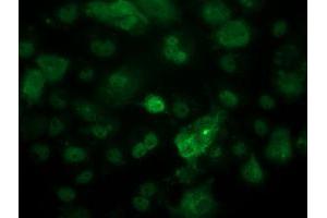 Image no. 4 for anti-Tumor Protein P53 (TP53) antibody (ABIN1499971) (p53 antibody)