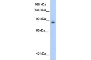 Western Blotting (WB) image for anti-Aconitase 1 (ACO1) antibody (ABIN2462120) (Aconitase 1 antibody)