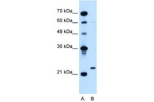 WB Suggested Anti-IGLL1  Antibody Titration: 5. (IGLL1 antibody  (N-Term))