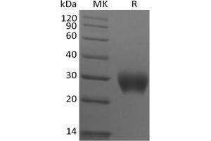 Western Blotting (WB) image for Leukocyte-Associated Immunoglobulin-Like Receptor 1 (LAIR1) protein (His tag) (ABIN7321031) (LAIR1 Protein (His tag))