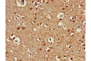 Immunohistochemistry of paraffin-embedded human brain tissue using ABIN7145099 at dilution of 1:100 (ATG13 antibody  (AA 315-517))