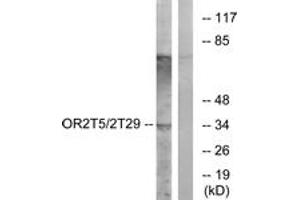 Western blot analysis of extracts from K562 cells, using OR2T5/2T29 Antibody. (OR2T5/2T29 antibody  (AA 66-115))