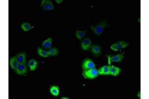 Immunofluorescent analysis of A431 cells using ABIN7164023 at dilution of 1:100 and Alexa Fluor 488-congugated AffiniPure Goat Anti-Rabbit IgG(H+L) (ATP12A antibody  (AA 171-306))