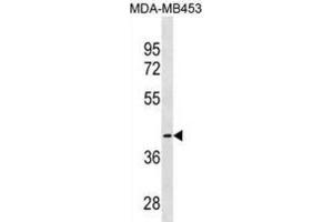 Western Blotting (WB) image for anti-Cysteine-S-conjugate beta-Lyase (CCBL1) antibody (ABIN3000294) (CCBL1 antibody)