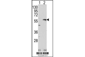 Western blot analysis of MMP13 using rabbit polyclonal MMP13 Antibody using 293 cell lysates (2 ug/lane) either nontransfected (Lane 1) or transiently transfected with the MMP13 gene (Lane 2). (MMP13 antibody  (C-Term))