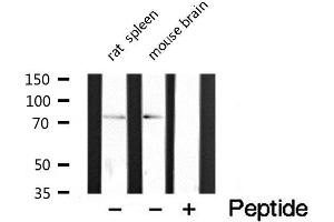 Western blot analysis of extracts of various tissue sample,using CLIP4 Antibody . (CLIP4 antibody  (Internal Region))