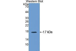 Detection of Recombinant IGFBP3, Rat using Polyclonal Antibody to Insulin Like Growth Factor Binding Protein 3 (IGFBP3) (IGFBP3 antibody  (AA 137-274))