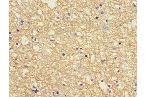 Immunohistochemistry of paraffin-embedded human brain tissue using ABIN7144042 at dilution of 1:100 (APP antibody  (AA 18-270))