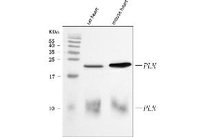Western blot analysis of PLN using anti-PLN antibody (ABIN7599122).