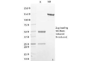 SDS-PAGE Analysis Purified STAT6 Mouse Monoclonal Antibody (STAT6/2410). (STAT6 antibody)