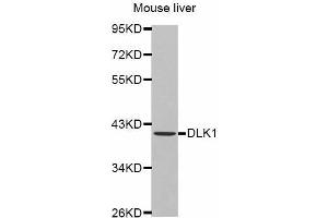 Western Blotting (WB) image for anti-delta-Like 1 Homolog (Drosophila) (DLK1) antibody (ABIN3016513)