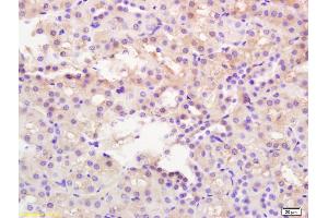 Formalin-fixed and paraffin embedded mouse kidney labeled with Rabbit Anti CaMK2 alpha Polyclonal Antibody, Unconjugated (ABIN1386359) at 1:200 followed by conjugation to the secondary antibody and DAB staining (CAMK2B antibody  (AA 101-200))