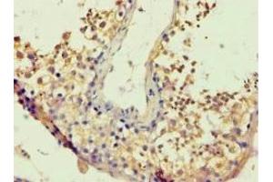 Immunohistochemistry analysis of paraffin-embedded (BACH1 antibody  (AA 1-320))