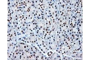 Immunohistochemical staining of paraffin-embedded colon tissue using anti-KIAA1609 mouse monoclonal antibody. (KIAA1609 antibody)