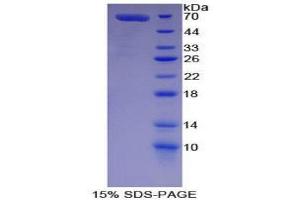 SDS-PAGE (SDS) image for Lactotransferrin (LTF) (AA 25-348) protein (His tag,GST tag) (ABIN2123142)
