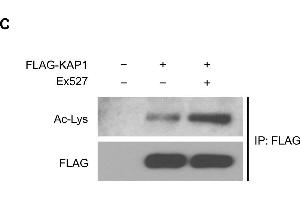 Western Blotting (WB) image for anti-Acetylated Lysine antibody (ABIN5596809)
