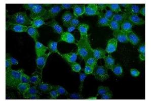 IF analysis of gamma Catenin using anti-gamma Catenin antibody (ABIN3043864). (JUP antibody  (AA 556-745))