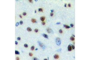 Immunohistochemical analysis of SNRPA staining in mouse brain formalin fixed paraffin embedded tissue section. (SNRPA1 antibody)