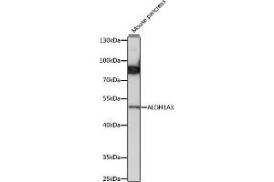 Western blot analysis of extracts of mouse pancreas, using  antibody (ABIN7265533) at 1:1000 dilution. (ALDH1A3 antibody  (AA 1-140))