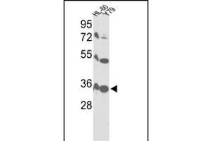 Western blot analysis of VDAC1 Antibody (Center) (ABIN390564 and ABIN2840894) in HL-60, Y79 cell line lysates (35 μg/lane). (VDAC1 antibody  (AA 95-124))