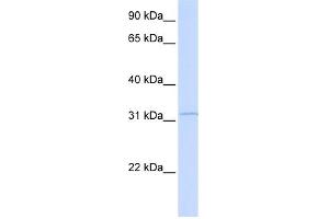 WB Suggested Anti-RDH12 Antibody Titration: 0. (RDH12 antibody  (Middle Region))