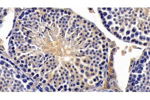 Detection of AMH in Mouse Testis Tissue using Monoclonal Antibody to Anti-Mullerian Hormone (AMH) (AMH antibody  (AA 453-560))