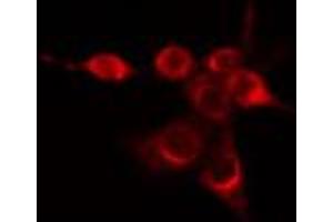 ABIN6274423 staining Hela cells by IF/ICC.