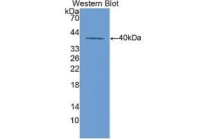Western blot analysis of the recombinant protein. (KRT20 antibody  (AA 75-382))