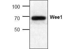 Image no. 1 for anti-WEE1 Homolog (S. Pombe) (WEE1) (C-Term) antibody (ABIN127016) (WEE1 antibody  (C-Term))