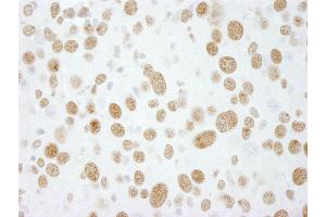 Immunohistochemistry (IHC) image for anti-RNA-binding protein Raly (RALY) (AA 256-306) antibody (ABIN7448753) (Raly antibody  (AA 256-306))