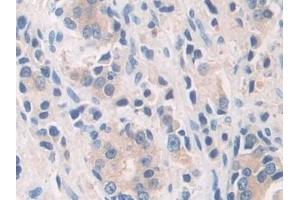 Immunohistochemistry (IHC) image for anti-Calcineurin (CAN) (AA 7-301) antibody (ABIN7433471)