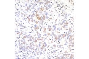 Immunohistochemistry (IHC) image for anti-Apoptosis Inhibitor 5 (API5) (AA 1-50) antibody (ABIN7453657)