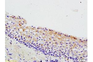 Immunohistochemistry (Paraffin-embedded Sections) (IHC (p)) image for anti-Wingless-Type MMTV Integration Site Family, Member 3A (WNT3A) (AA 281-352) antibody (ABIN733178)