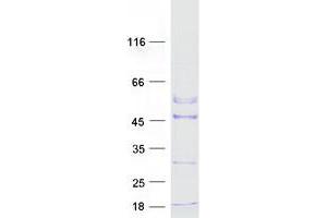Western Blotting (WB) image for Actin-Related Protein T2 (ACTRT2) protein (Myc-DYKDDDDK Tag) (ABIN2714374)
