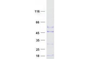 Validation with Western Blot (ACTRT2 Protein (Myc-DYKDDDDK Tag))