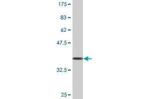 Western Blot detection against Immunogen (36. (ENTPD4 antibody  (AA 371-469))