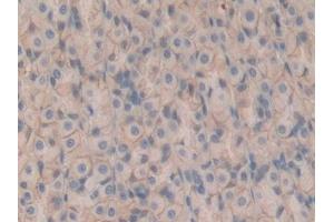 Detection of CD147 in Rat Stomach Tissue using Polyclonal Antibody to Cluster Of Differentiation 147 (CD147) (CD147 antibody  (AA 59-321))