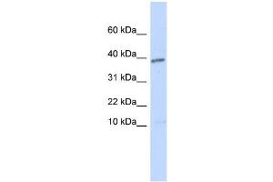 WB Suggested Anti-LEFTY1 Antibody Titration: 0. (LEFTY1 antibody  (N-Term))
