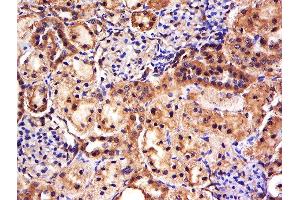 Formalin-fixed and paraffin embedded rat kidney labeled with Anti-FAM171A1 Polyclonal Antibody, Unconjugated  at 1:500 followed by conjugation to the secondary antibody and DAB staining. (FAM171A1 antibody  (AA 201-300))